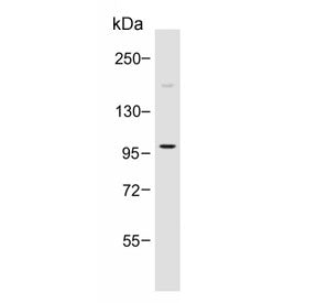 Western blot testing of human HT-1080 cell lysate with PI3K delta antibody. Expected molecular weigh