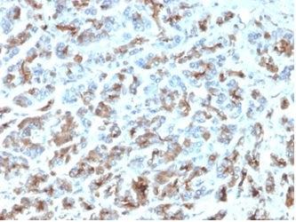 IHC staining of FFPE human stomach with MICA antibody (clone MICA/4443). HIER: boil tissue sections 