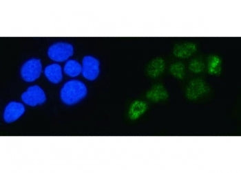 Immunofluorescent staining of FFPE human A431 cells with ALYREF antibody (green) and DAPI nuclear st