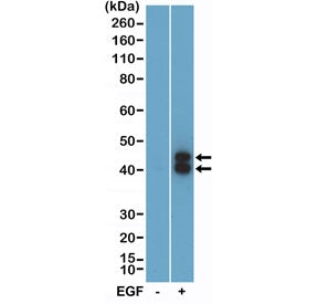 Phospho-ERK1/2 Antibody (pThr202/pTyr204)
