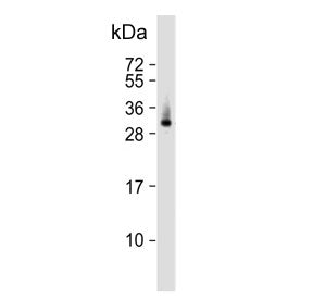 ELOVL6 Antibody