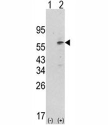 PDK1 Antibody