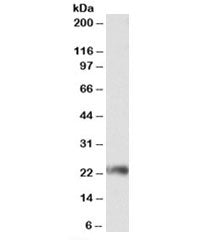 Western blot testing of Jurkat lysate with CD3G antibody at 0.3ug/ml. Predicted molecular weight: ~2