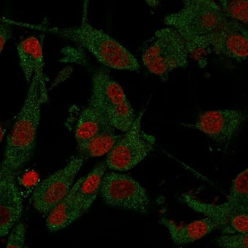 Immunofluorescent staining of PFA-fixed human U-87 MG cells with Amyloid Beta antibody (clone APP/33