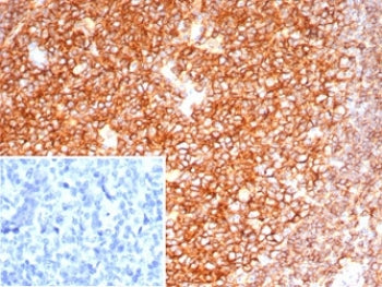 IHC staining of FFPE human tonsil tissue with CD19 antibody (clone CD19/7665). HIER: boil tissue sec