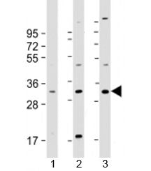 FAM125A Antibody / CFBP