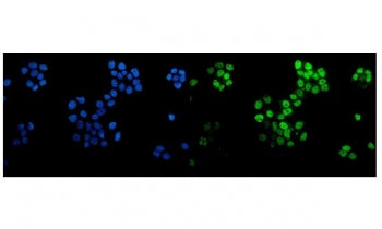 Immunofluorescent staining of FFPE human A431 cells with p63 antibody (green) and DAPI nuclear stain