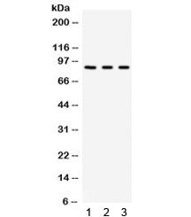 Western blot testing of human 1) A549, 2) 293 and 3) HeLa cell lysate with Complement Factor B antib