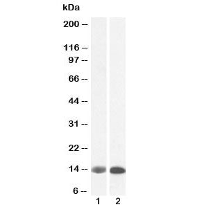 FABP1 Antibody (liver)