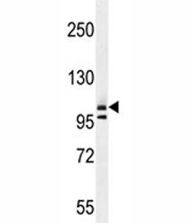 Collagen I Antibody / COL1A2