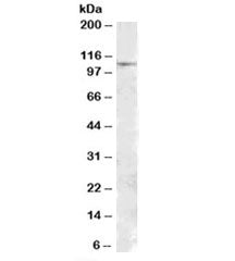 Western blot testing of human substantia nigra lysate with MTHFD1 antibody at 1ug/ml. Predicted mole