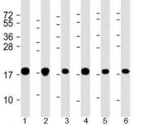 COMMD1 Antibody
