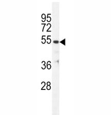 TUBB Antibody