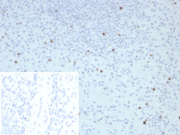 IHC staining of FFPE human spleen tissue with Perforin-1 antibody (clone PRF1/8662R). Inset: PBS use