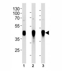 HLA-G antibody western blot analysis in (1) A549, (2) Ramos, (3) MDA-MB-231 lysate. Predicted molecu