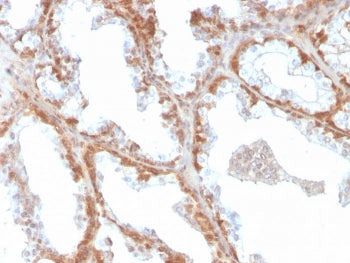 SOD1 Antibody / Superoxide Dismutase 1