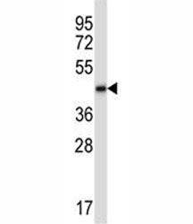 BMP2 Antibody