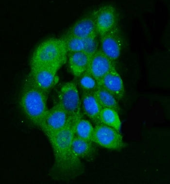 Immunofluorescent staining of FFPE human A431 cells with Integrin Linked Kinase antibody (green) and