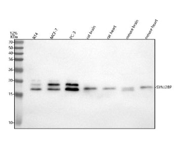 Western blot analysis of SYNJ2BP using anti-SYNJ2BP antibody. Lane 1: human RT4 whole cell lysates, 