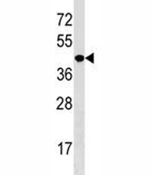 NKX2.5 Antibody