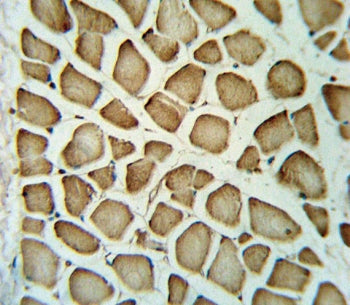 FGG Antibody / Fibrinogen gamma chain / FIBG
