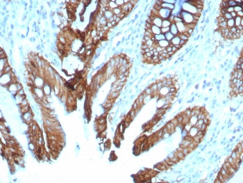 IHC staining of FFPE human colon tissue with Cadherin 17 antibody (clone rCDH17/8512). HIER: boil ti