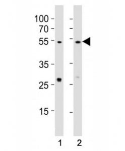 Western blot testing of EED antibody at 1:1000 dilution. Lane 1: A431 lysate; 2: NIH3T3 lysate; Pred