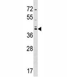 SOX7 antibody western blot analysis in HepG2 lysate. Predicted molecular weight: 42/49 kDa (isoforms