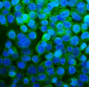 RPL13A Antibody