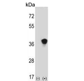 MEK3 Antibody / MAP2K3 / MKK3