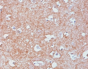 Neurofilament Antibody (-Light) / NF-L / NEFL