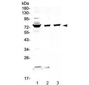 Western blot testing of 1) human HepG2, 2) human K562 and 3) mouse NIH3T3 cell lysate with FUS antib