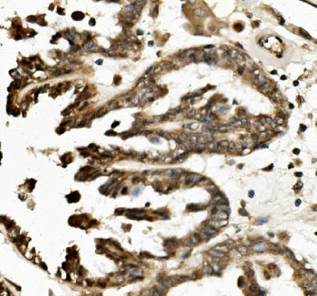 TXNIP Antibody