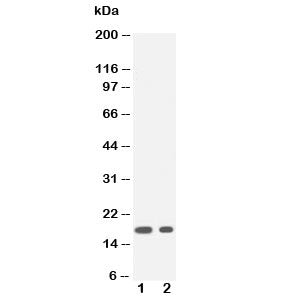 IL1 beta Antibody
