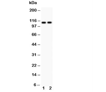 ATP2A3 Antibody