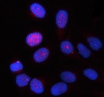 TTC9 Antibody / Tetratricopeptide repeat protein 9A