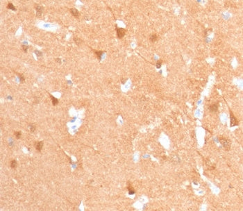 PGP9.5 / UchL1 Antibody