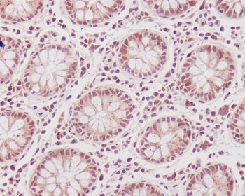 CDK1 Antibody
