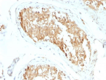 ALDH1A1 Antibody / Acetaldehyde dehydrogenase 1