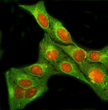 SIX4 Antibody / Sine oculis homeobox homolog 4