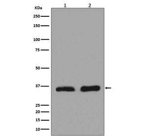 LDHA Antibody / Lactate dehydrogenase A