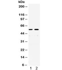 Western blot testing of human 1) SW620 and 2) A431 cell lysate with XRCC4 antibody. Predicted molecu