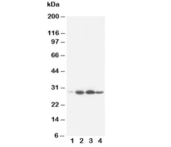 Bcl-2 Antibody