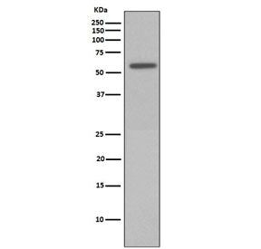 Phospho-Vimentin Antibody (pS72)