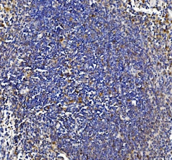 IL18 Antibody