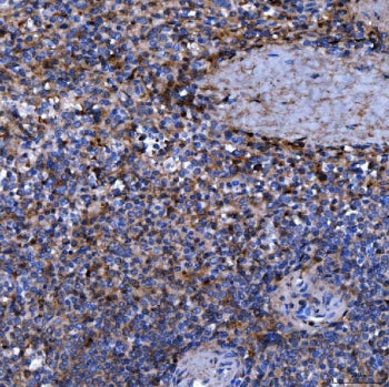 SEPT11 Antibody / Septin 11