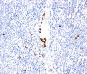 IHC staining of tonsil tissue with Granulocyte Marker antibody (clone BM-2). Note specific cytoplasm