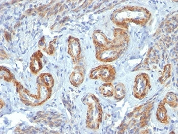 SMMHC Antibody (Smooth Muscle Myosin Heavy Chain)