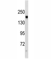 TSC1 Antibody