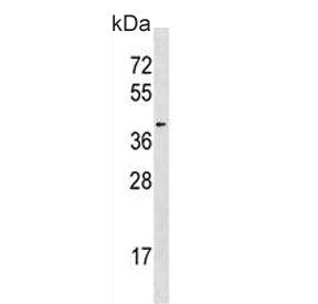 HDAC11 Antibody
